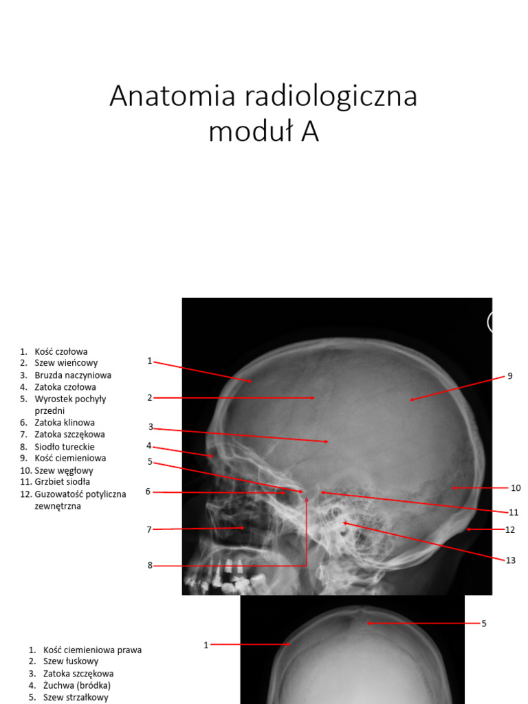 Anatomia Radiologiczna Moduł A | PDF