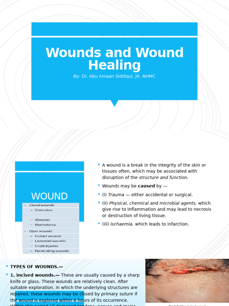 Wounds and Wound Healing | PDF | Wound Healing | Healing