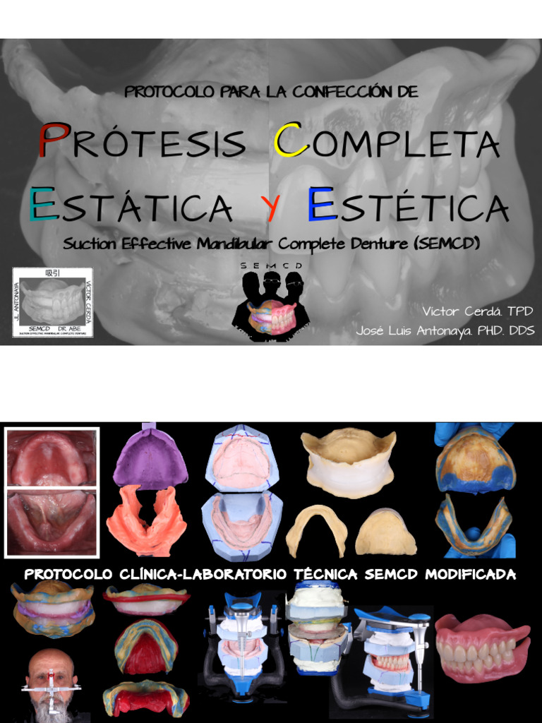Protocolo SEMCD para Prótesis Completa | PDF | Odontología