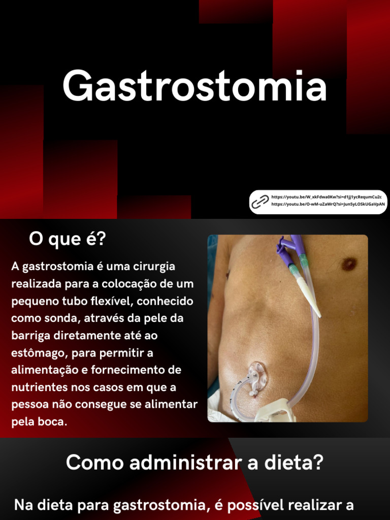 Cuidados e Complicações da Gastrostomia | PDF | Esôfago | Estômago