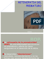 Retinopatía Del Prematuro