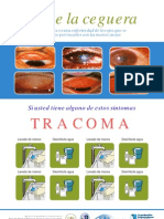 Tracoma