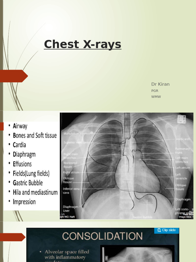 Xrays | PDF