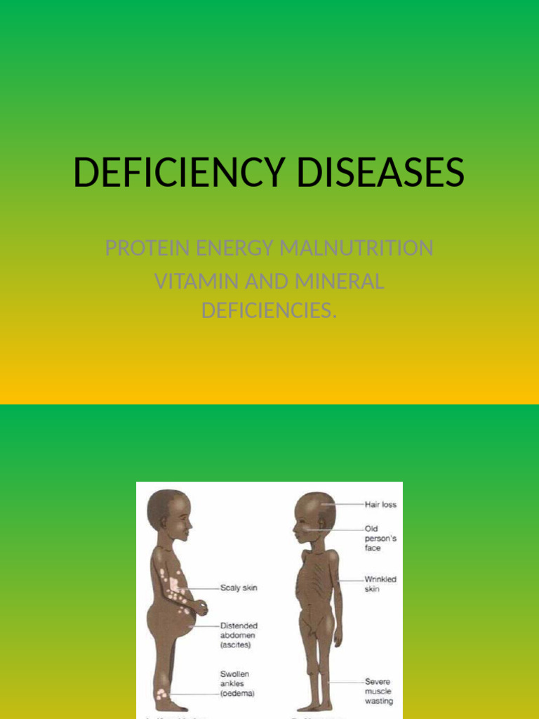 Understanding Deficiency Diseases and Malnutrition | PDF | Malnutrition ...