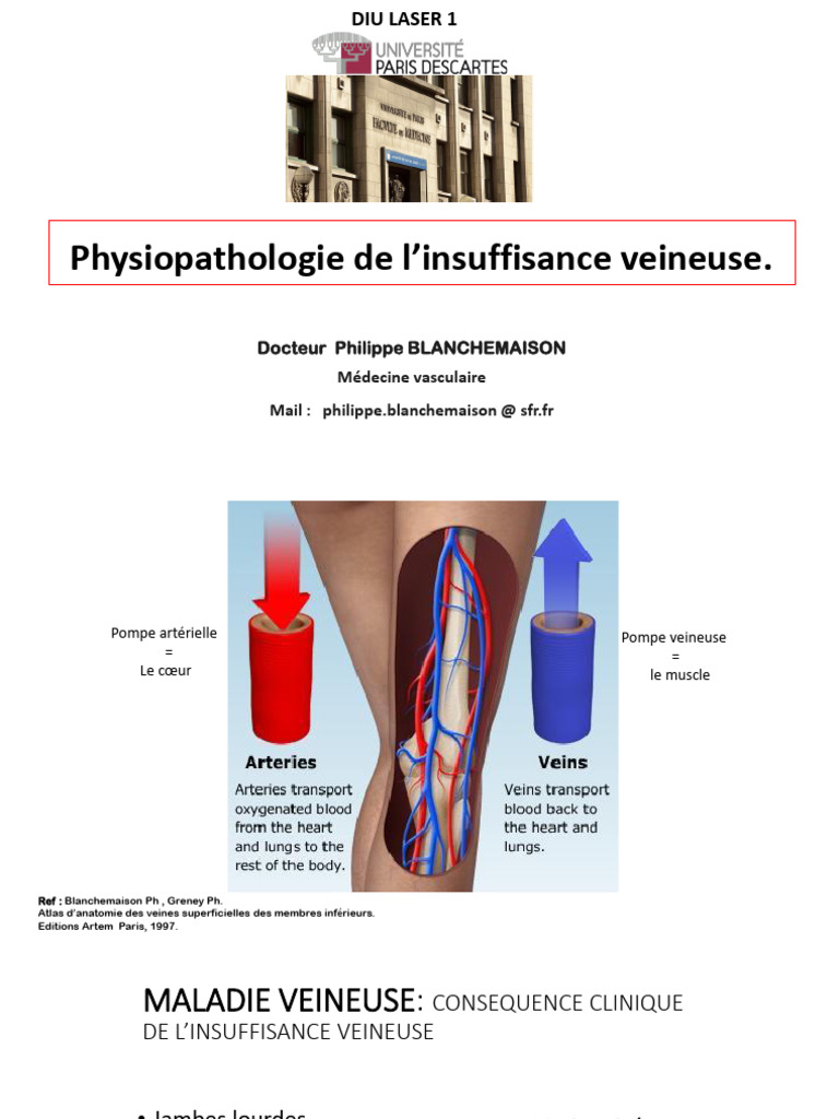 Physiopathologie de l'insuffisance veineuse PDF Varices — free download