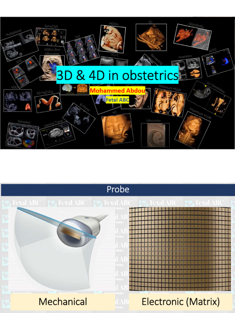 3D and 4D Ultrasound Techniques in Obstetrics | PDF | Rendering ...