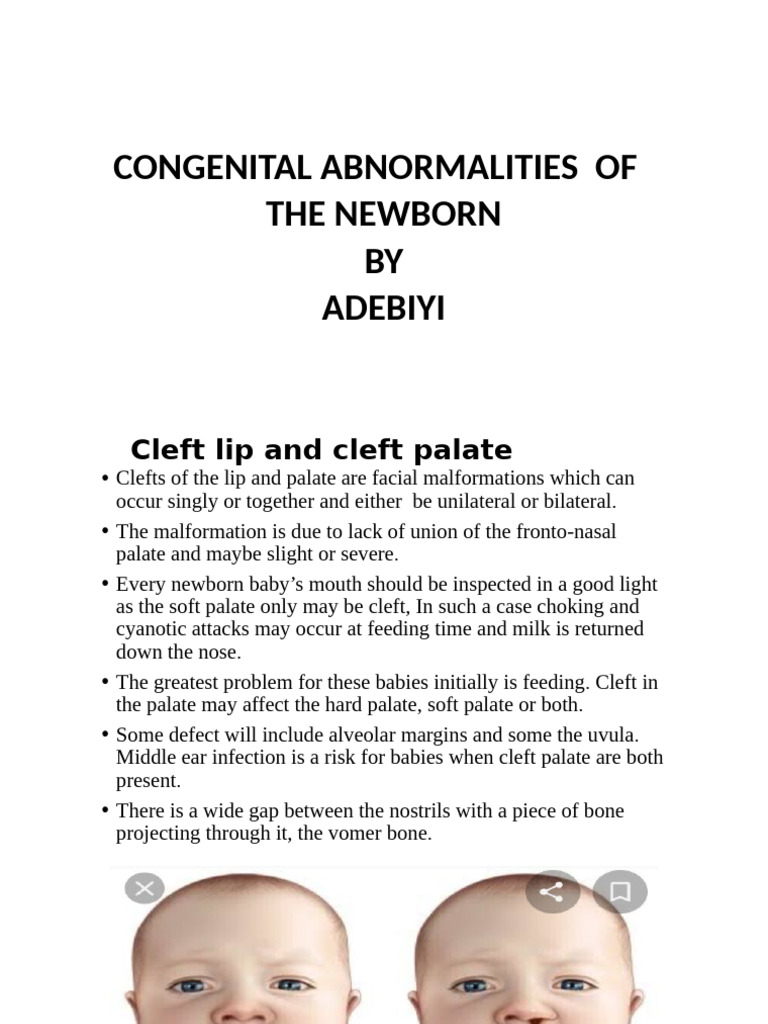 Micropenis and Congenital Anomalies | PDF | Medical Specialties ...