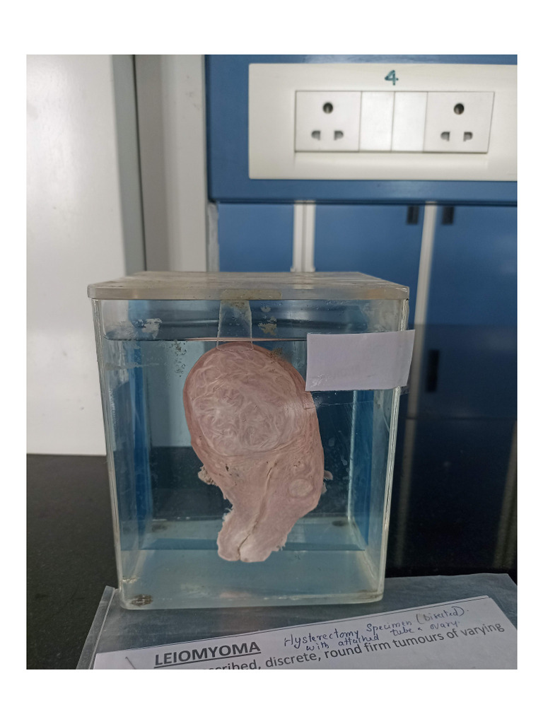 Pathology Gross Specimen | PDF