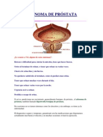 Síntomas y tratamientos del adenoma de próstata