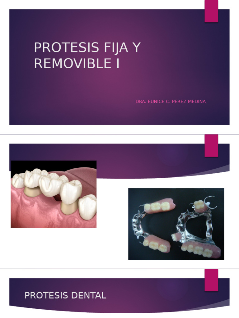 Guía Completa sobre Prótesis Fijas Dentales | PDF | Odontología | Diente