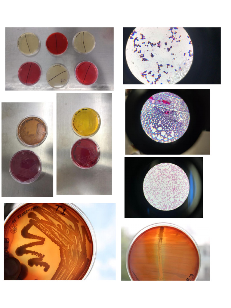 Bacter | PDF