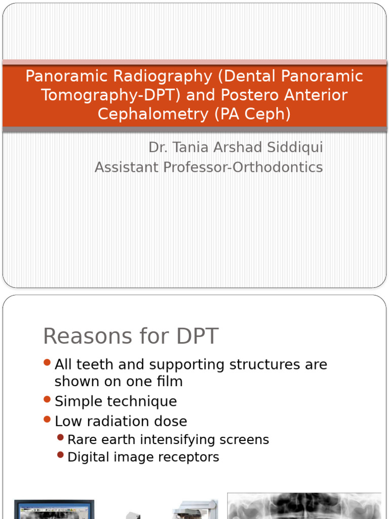 Overview of Dental Panoramic Tomography | PDF | Skull | Medical Specialties