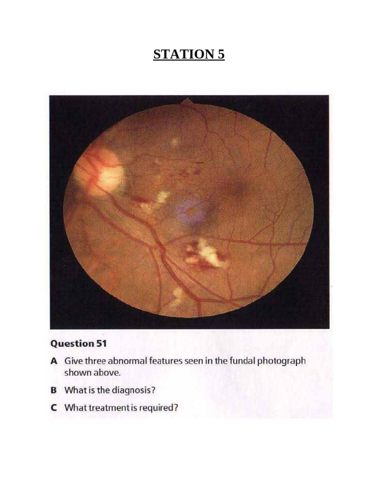 Understanding TOACS in Clinical Scenarios | PDF