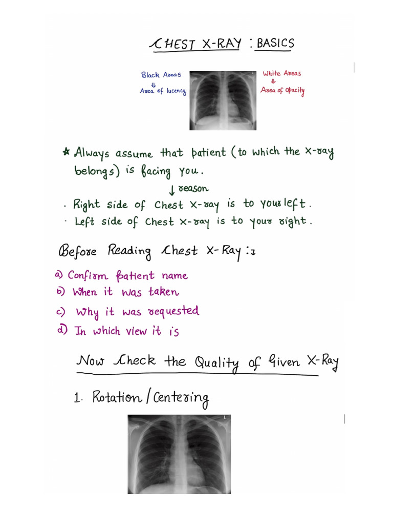 Chest X Ray Medicine | PDF