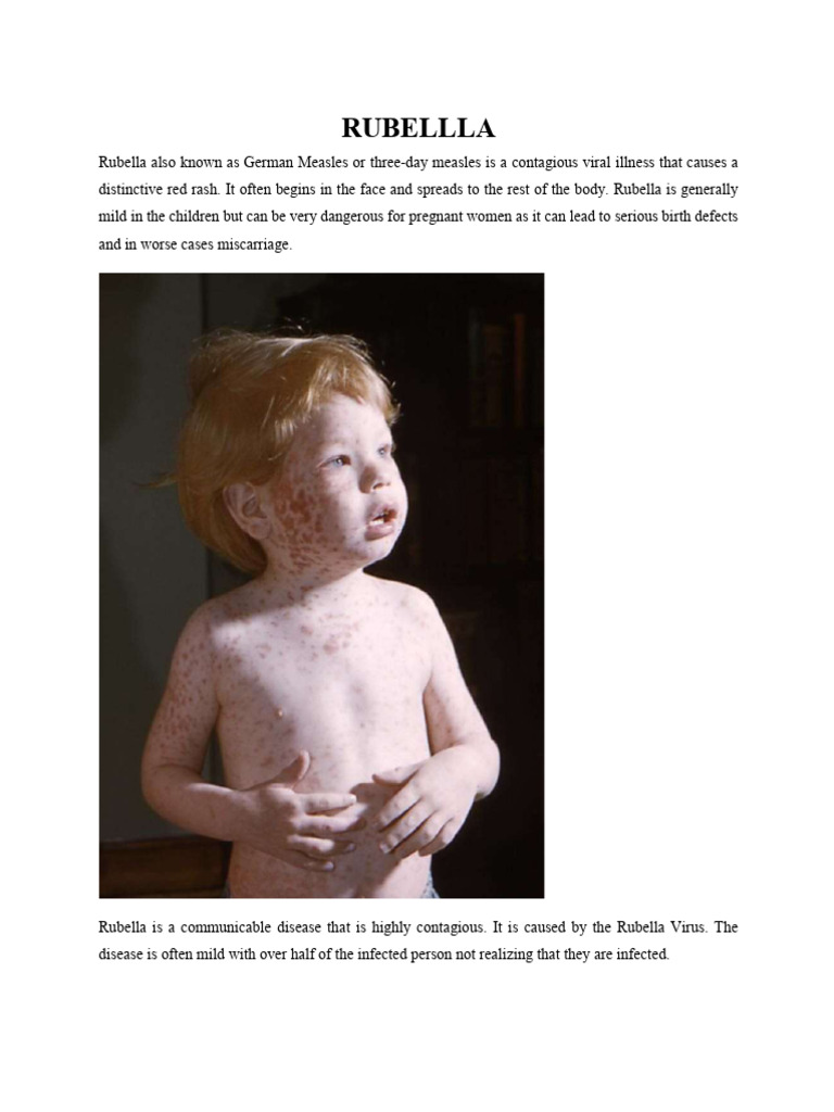Rubella: Symptoms and Risks Explained | PDF | Vaccines | Measles