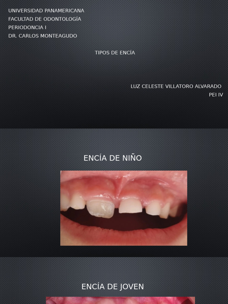 Tipos de Encia 00131728 Luz Celeste Villatoro | PDF