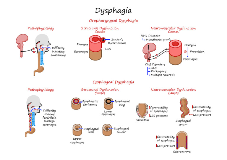 1 - Dysphagia (Illustrations Key) | PDF | Esophagus | Digestive Diseases