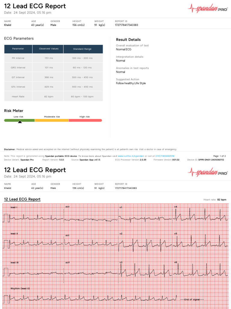 Spandan Portable ECG Report for Khalid | PDF | Electrocardiography | Heart