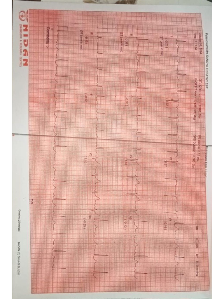 ECG | PDF