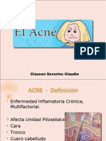 Acne y Rosacea