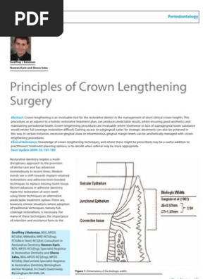 Crown Lengthening