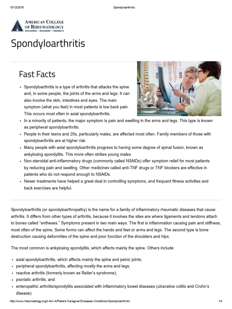 Ankylosing Spondylitis | PDF | Medical Specialties | Diseases And Disorders