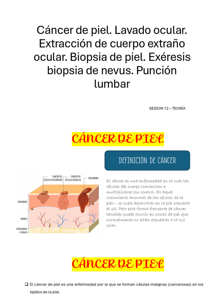 Exposicion Cancer de Piel. Puncion Lumbar | PDF | Cáncer | Cáncer de piel