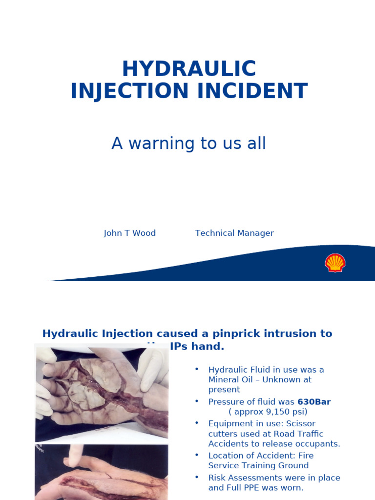 Hydraulic Injection Injury Case Study | PDF