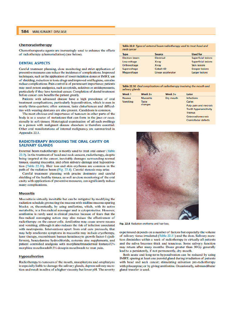 Head and Neck Cancer | PDF