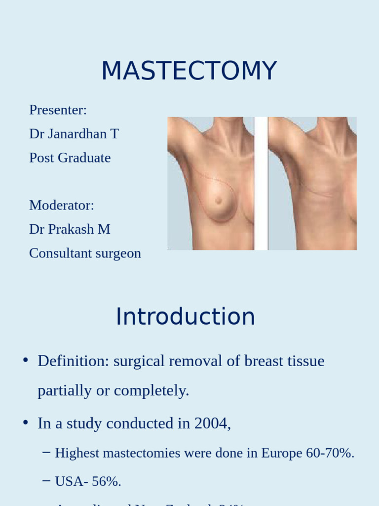 Mastectomy Types and Indications | PDF | Mastectomy | Breast Cancer