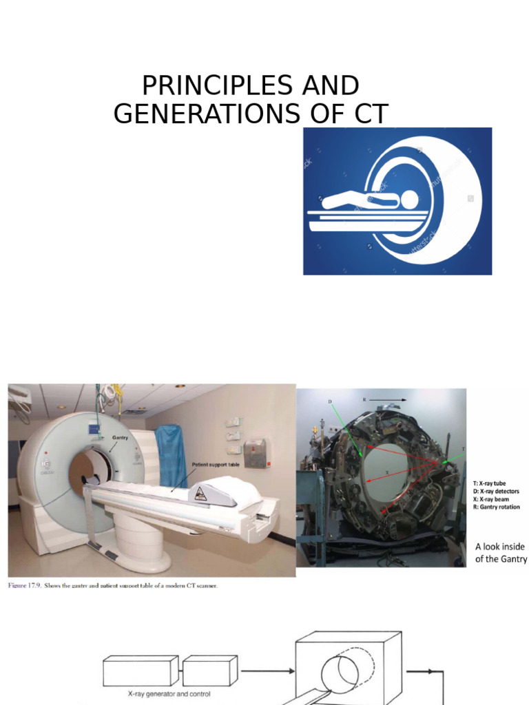 Overview of CT Principles and Generations | PDF | Ct Scan | X Ray