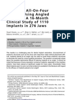 Maxillary All On Four Therapy Using Angled Implants