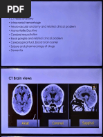 CT Scan Brain Procedure Codes Overview | PDF | Headache | Dementia