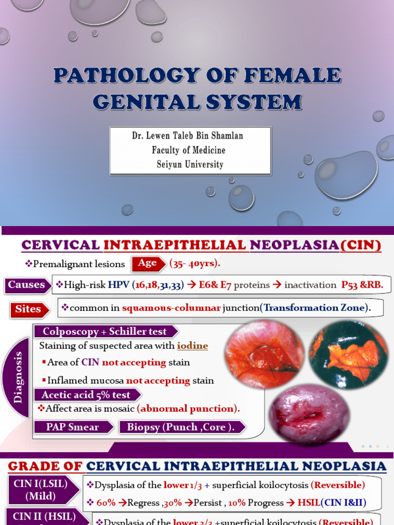 Female Genital Pathology Overview | PDF | Ovarian Cancer | Medical ...