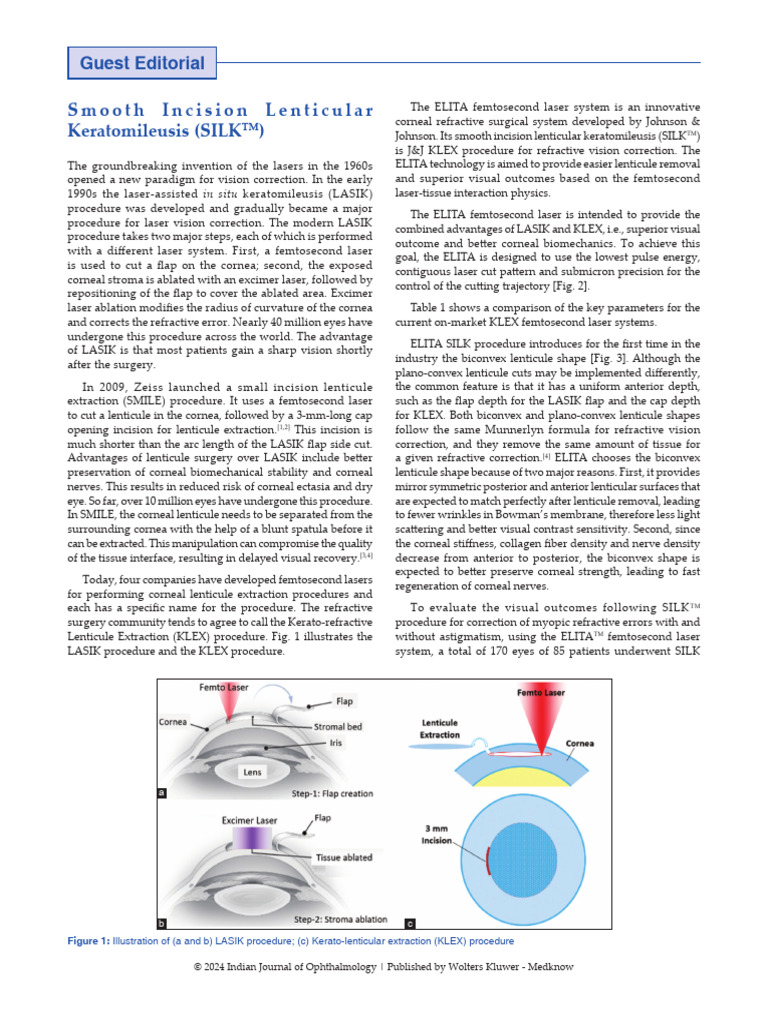 Smooth Incision Lenticular Keratomileusis Silktm .3 | PDF | Cornea ...