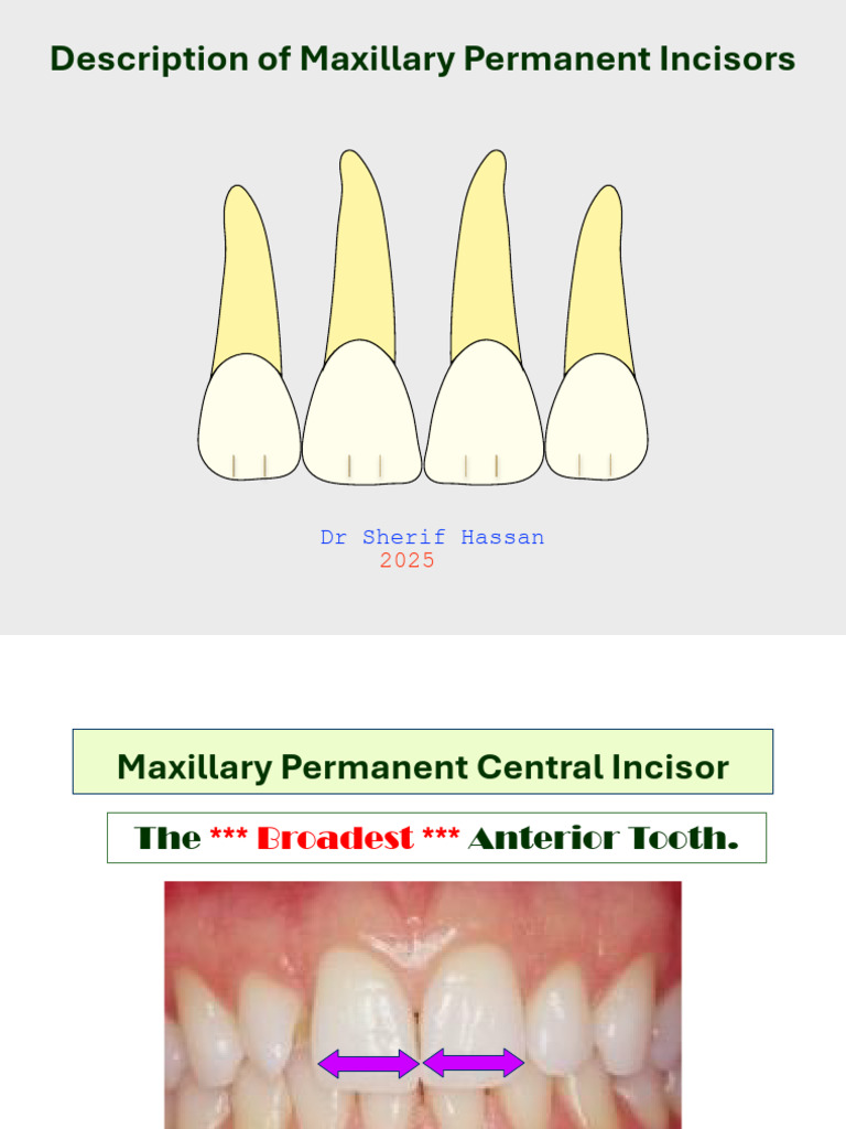 Maxillary Permanent Incisors Overview | PDF | Dental Anatomy | Tooth