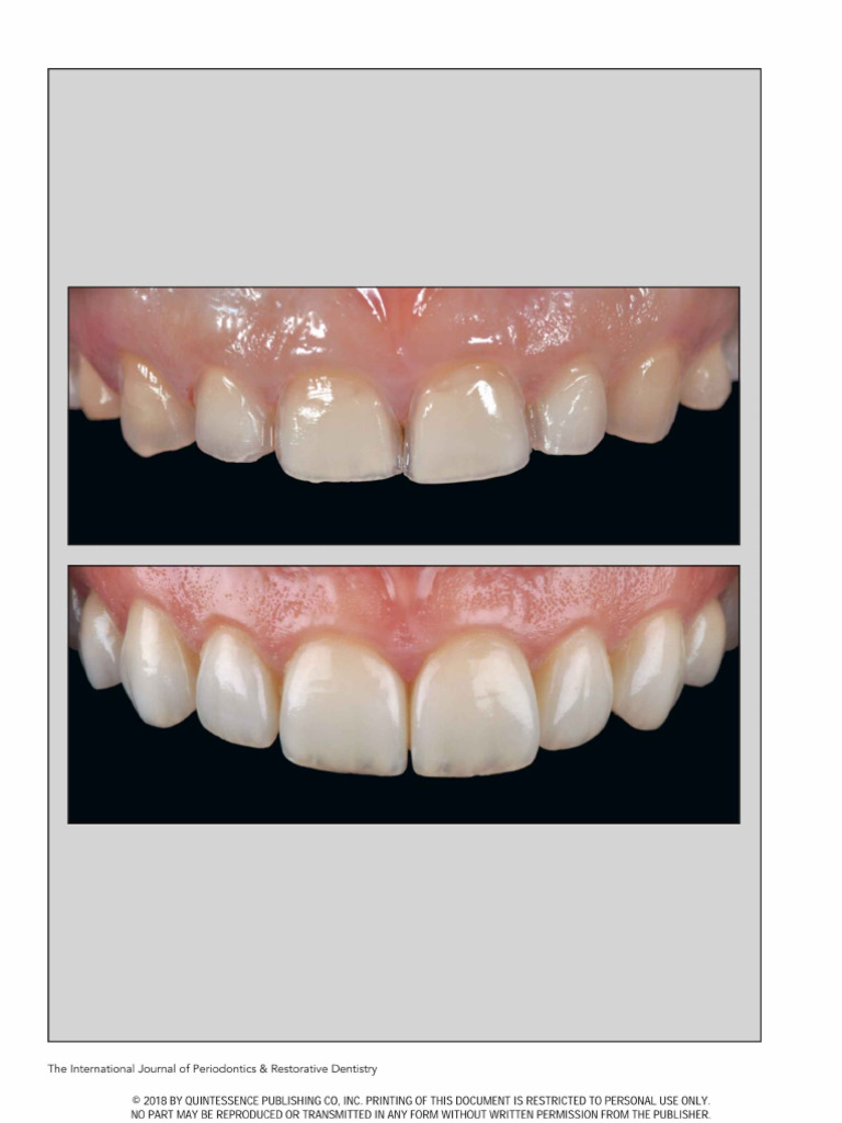 Table Top Restorations | PDF
