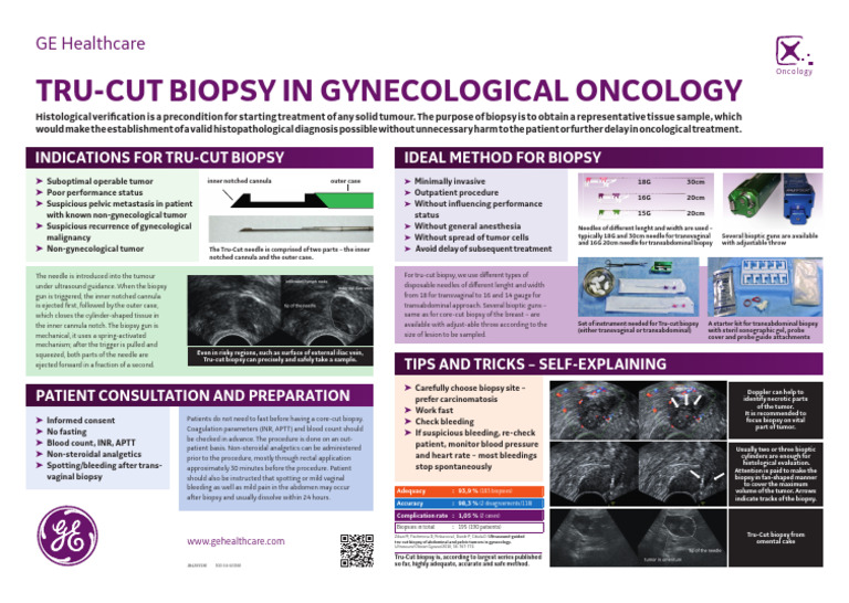 300 16 U036E - JB42655XE - Poster A3 - Tru Cut Biopsy | PDF | Biopsy ...