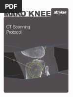 Mako Knee CT Scanning Protocol | PDF | Pelvis | Knee