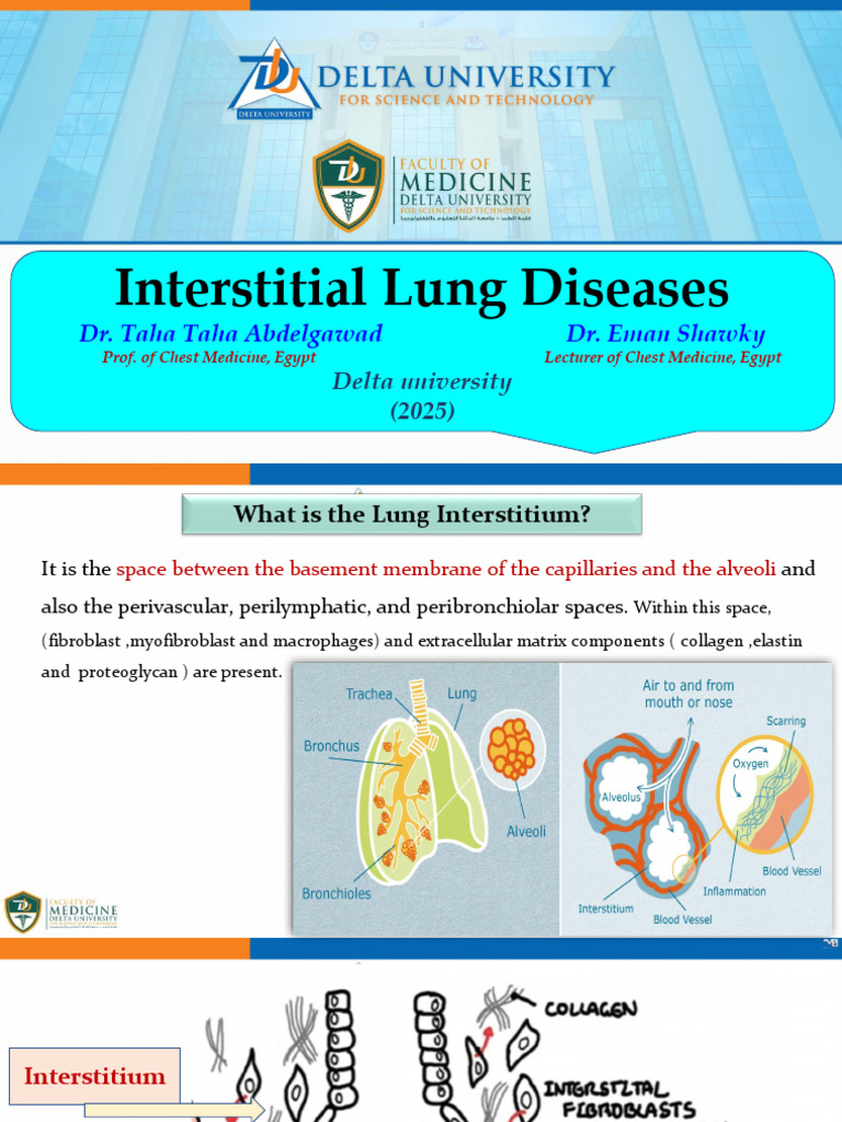 Understanding Interstitial Lung Diseases | PDF | Respiratory Diseases ...