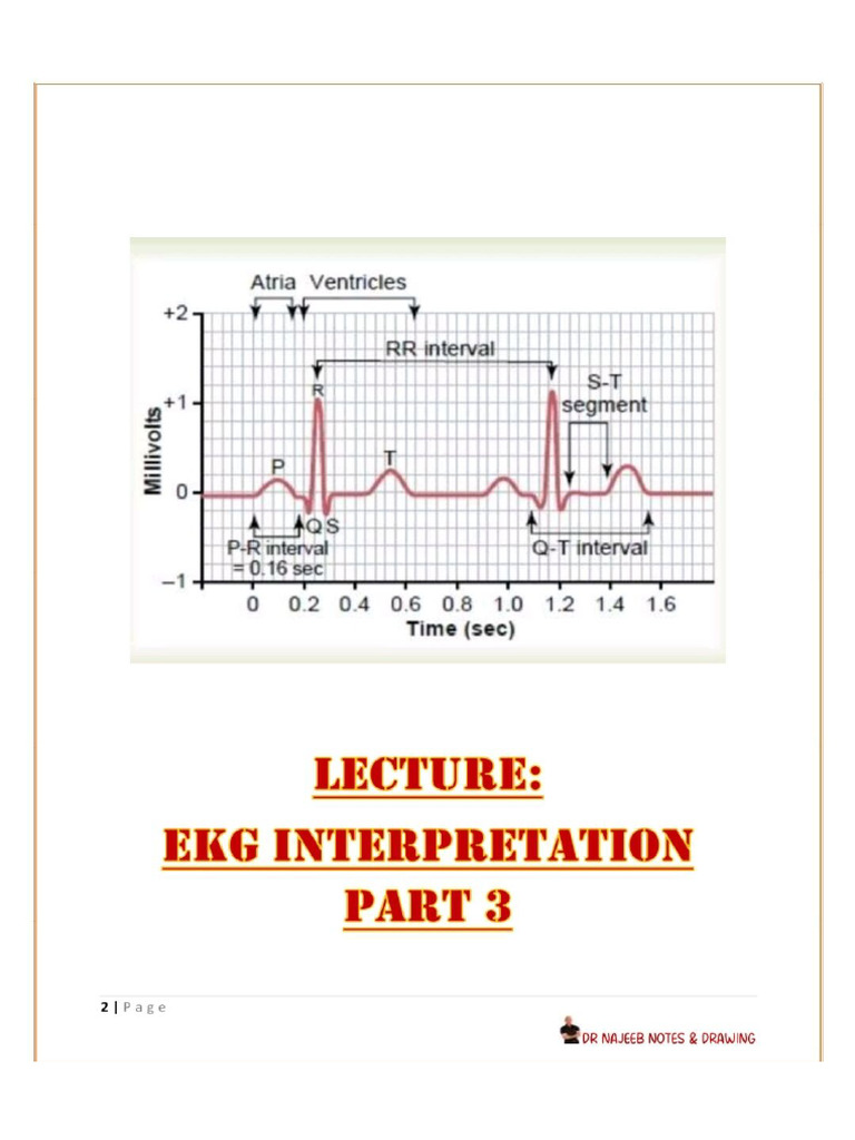 EKG Interpretation Part 3. | PDF