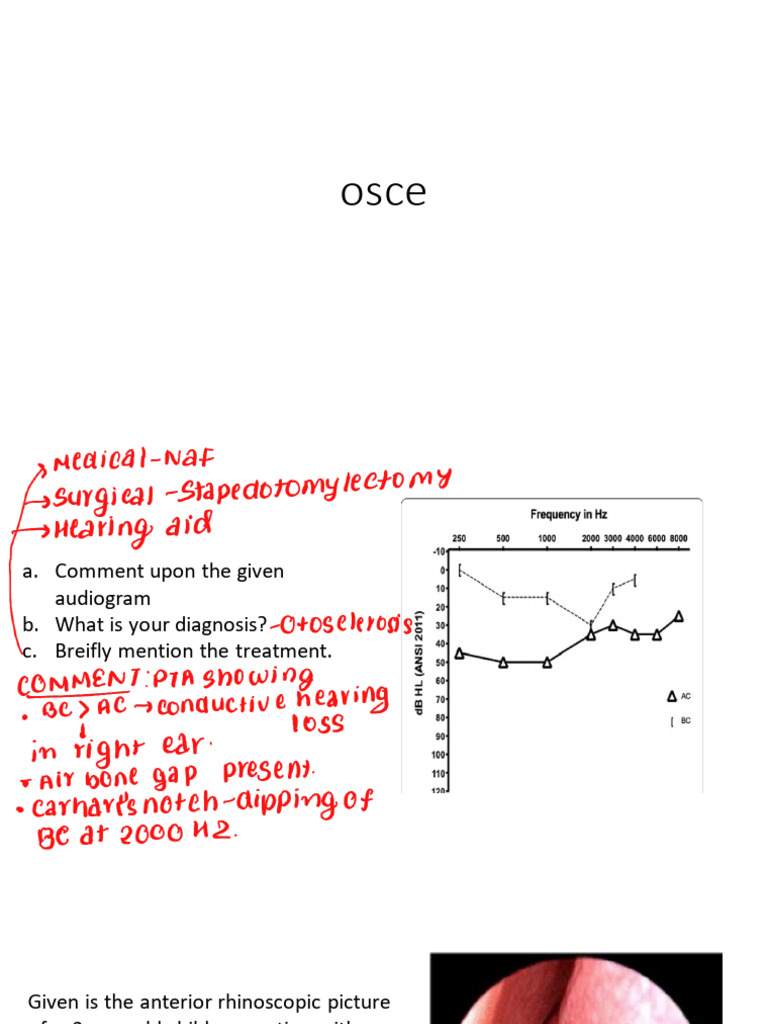 ENT Case Studies and Diagnoses Guide | PDF | Diseases And Disorders ...