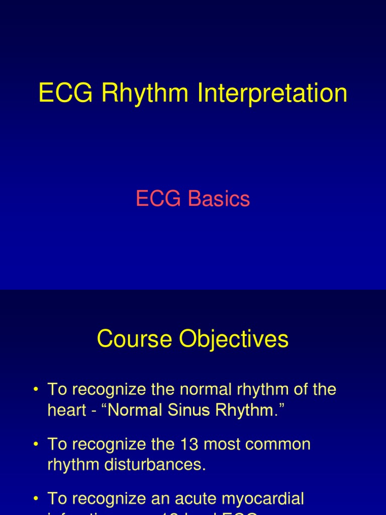 ECG Rhythm Interpretation Guide | PDF