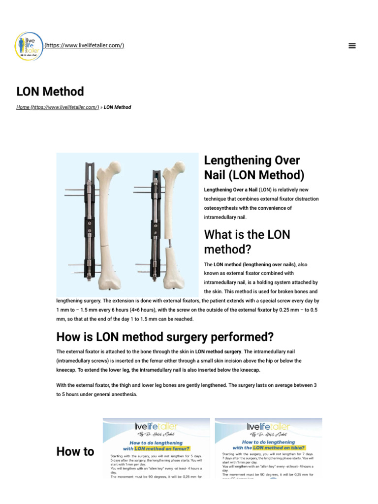 LON Method: Limb Lengthening Explained | PDF | Surgery | Pain