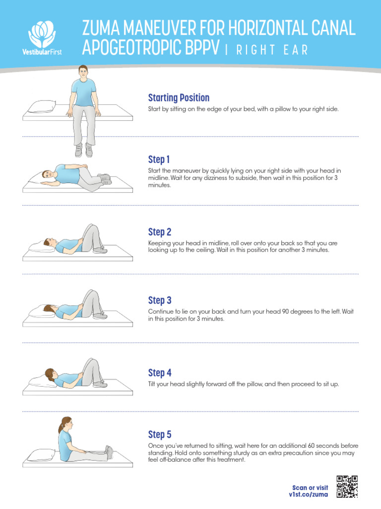 Zuma Maneuver for BPPV Treatment | PDF