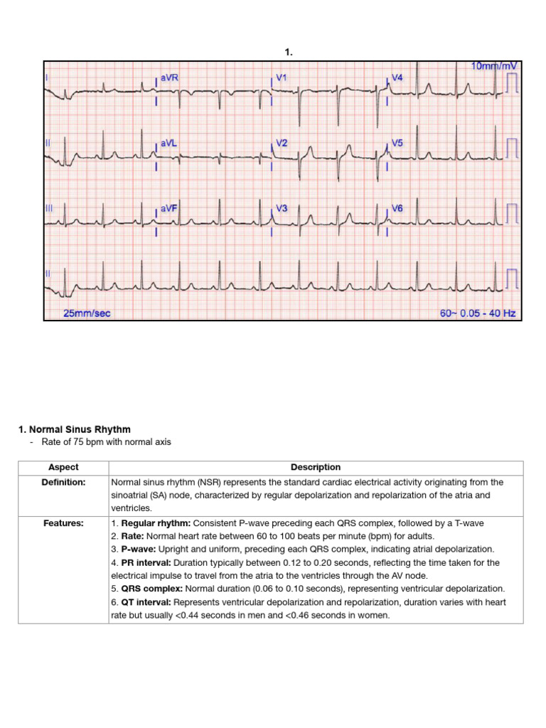 ECG Abnormalities and Management Guide | PDF | Electrocardiography ...