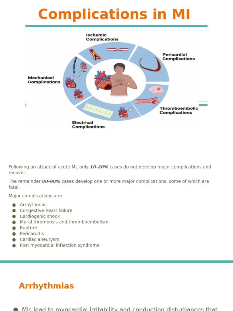 Major Complications of Myocardial Infarction | PDF | Heart | Heart Failure