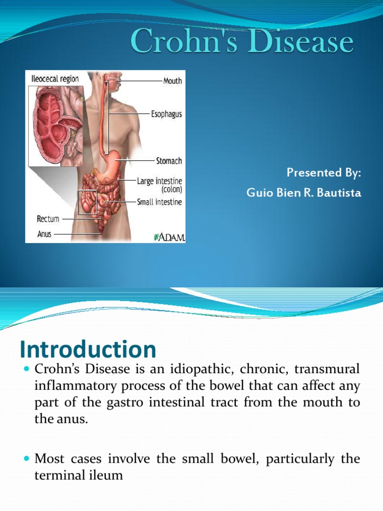 Chron's Disease Report | PDF | Crohn's Disease | Ulcerative Colitis