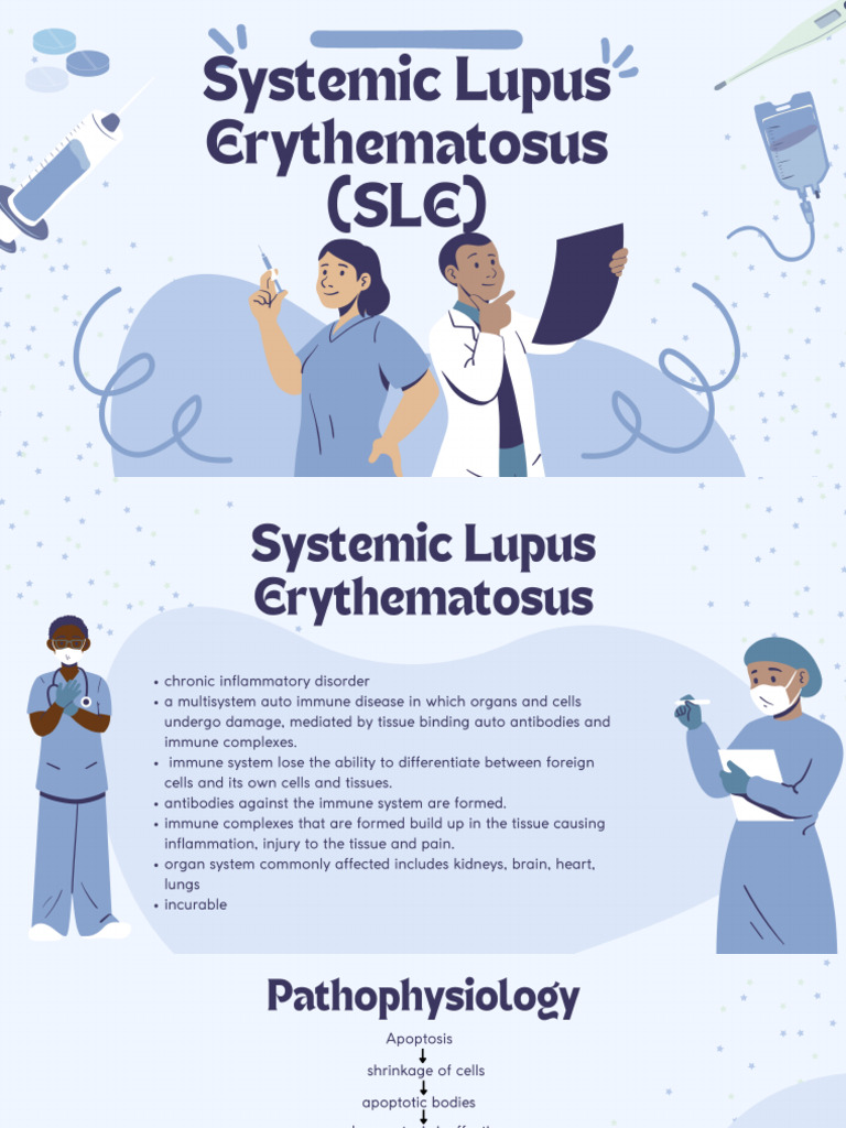 Systemic Lupus Erythematosus | PDF