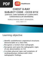 Download CHEST X-RAY Presentation CVS by Norsafrini Rita Ahmad SN89451170 doc pdf